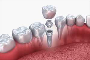 clinicas dentales en monterrey Dentistas en Monterrey CR Especialidades Dentales