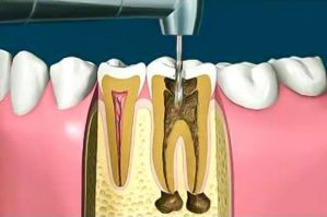 clinicas dentales en monterrey Dentistas en Monterrey CR Especialidades Dentales