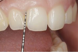 clinicas dentales en monterrey Dentistas en Monterrey CR Especialidades Dentales