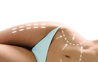 Multiple procedures